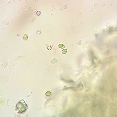 Bacillus Subtilis